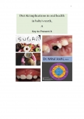 DIET & IMPLICATIONS IN ORAL HEALTH  IN BABY’S TEETH (eBook)