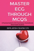 Master ECG Through MCQs