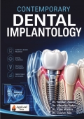 Contemporary Dental Implantology